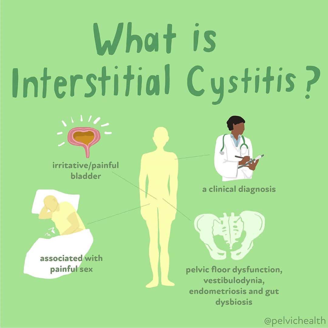 WhatisIC Interstitial Cystitis