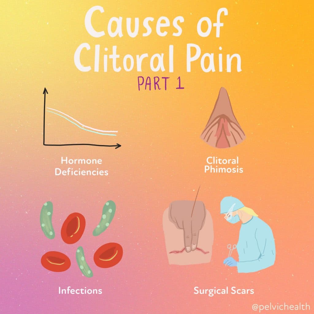 clitoralpain_ causes pt 1