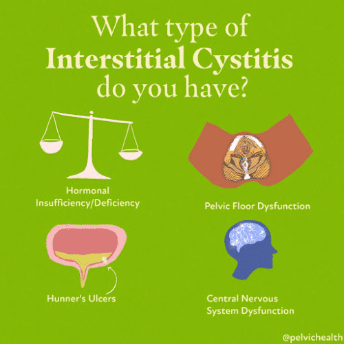Interstitial Cystitis Berkeley Symptoms-1 Interstitial Cystitis Berkeley Symptoms