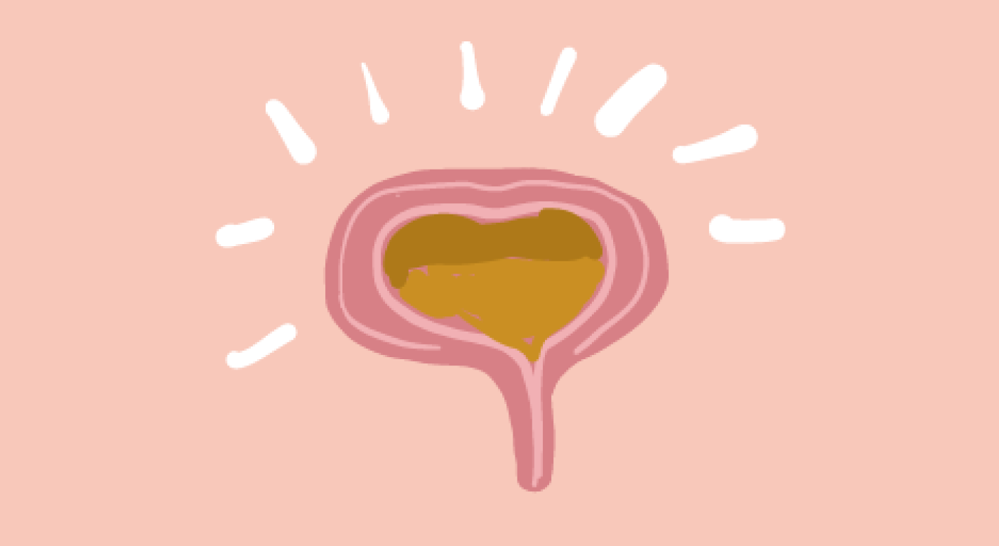 Interstitial Cystitis Berkeley banner Interstitial Cystitis