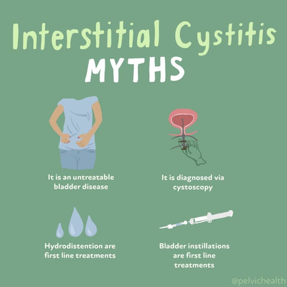 Interstitial Cystitis Berkeley left Interstitial Cystitis Myths