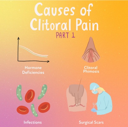 The-symptoms-of-clitoral-pain The-symptoms-of-clitoral-pain