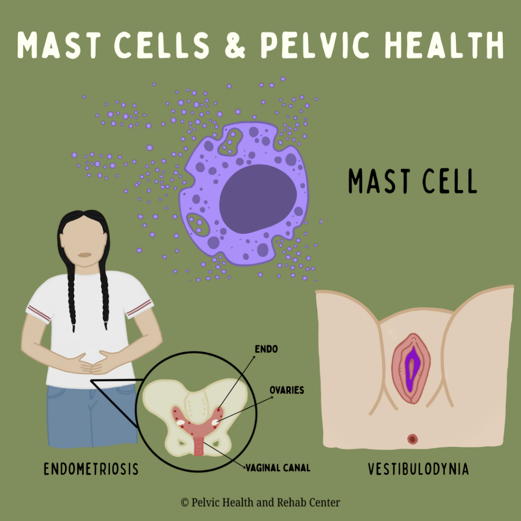 Mast Cells & Pelvic Health