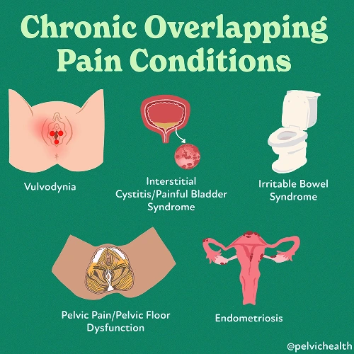 Chronic Overlapping Chronic Overlapping